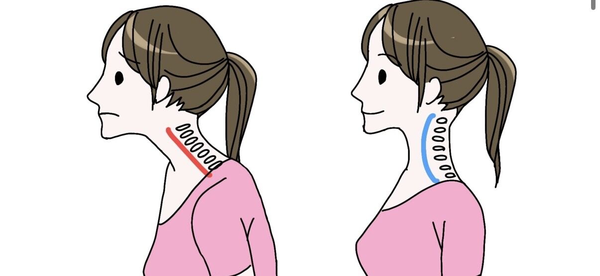 【セルフチェック】あなたの首肩、実は限界かも？